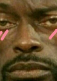 DMNKD